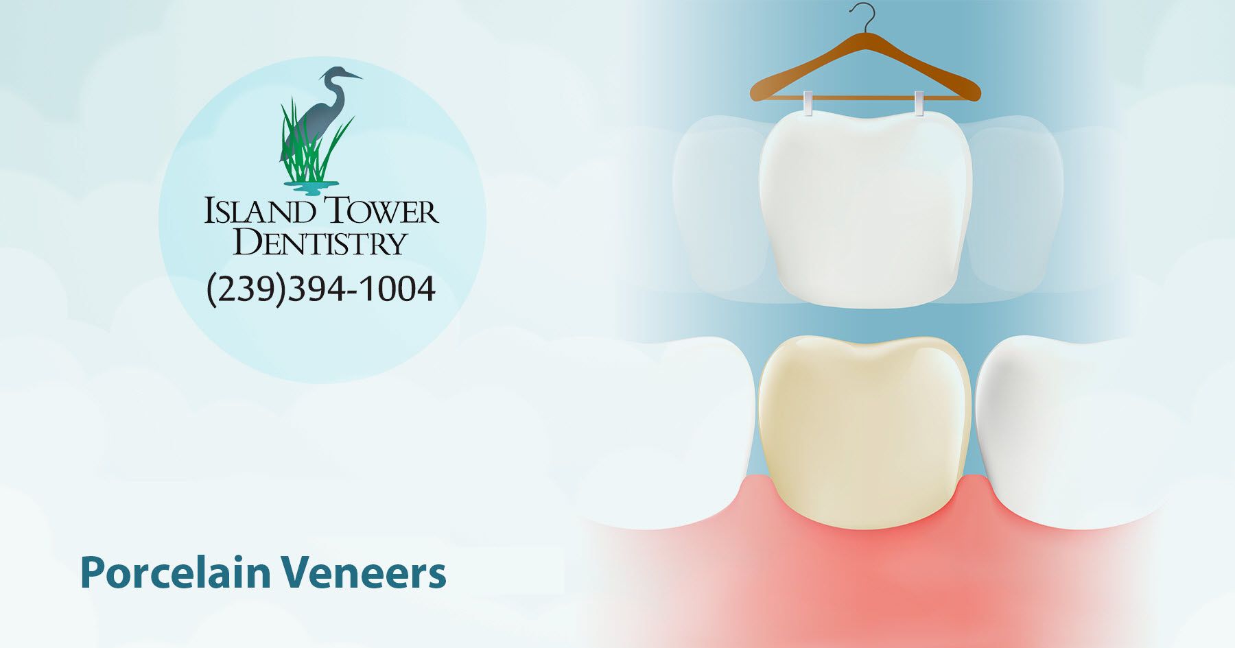 Porcelain Veneers Island Tower Dentistry on Marco Island