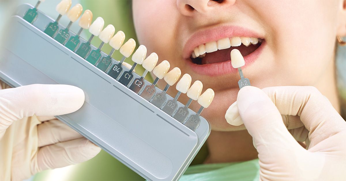 professional teeth whitening is better than over-the-counter techniques