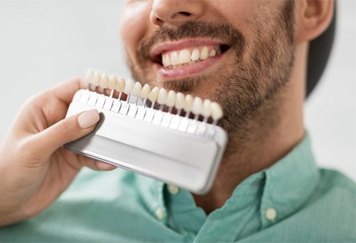 man choosing veneer shade 