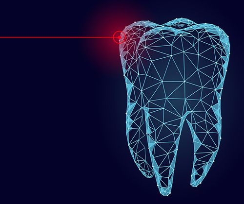 Laser gum surgery