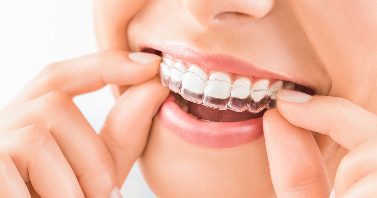 Invisalign at Island Tower Dentistry