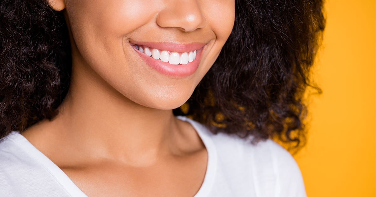 Dental Veneers