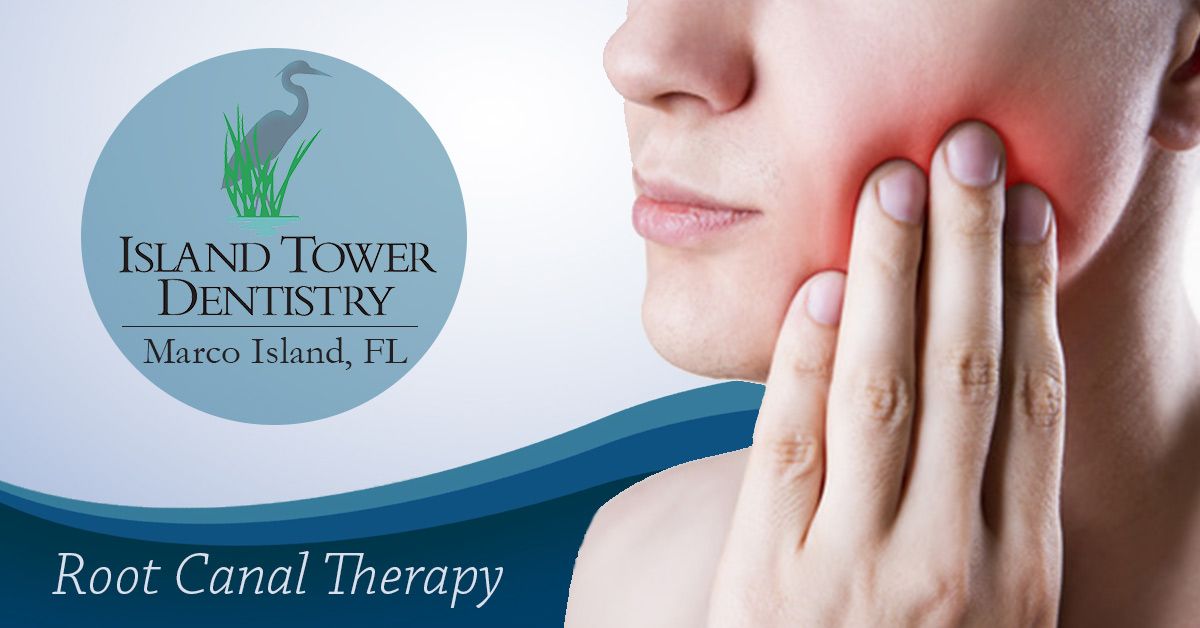 Marco Island Dentist Root Canal therapy