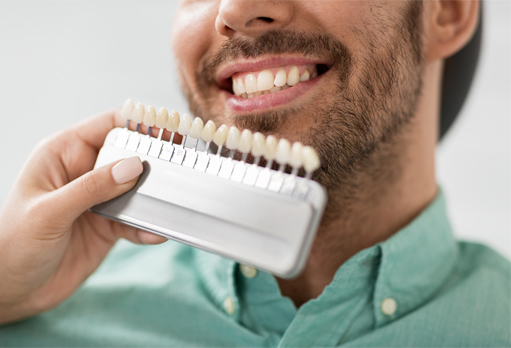 man choosing veneer shade
