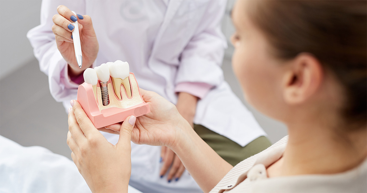 How Long Dental Implants Last