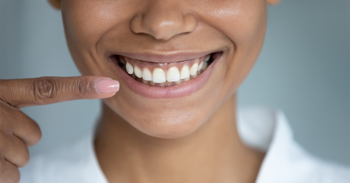 Benefits of Gum Contouring at Island Tower Dentistry