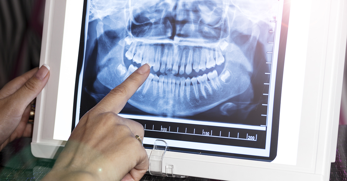 Dental work reviewd and replaced