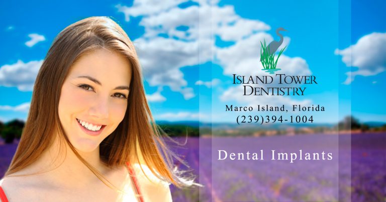 dental implants